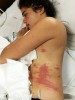 The Truth About Anne Curtis and Jellyfish Stings